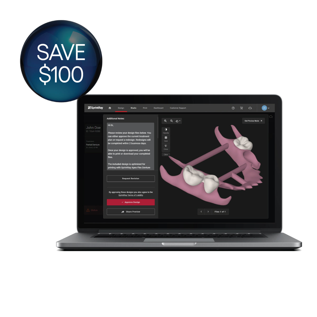 SprintRay Design Offer ($600 value)